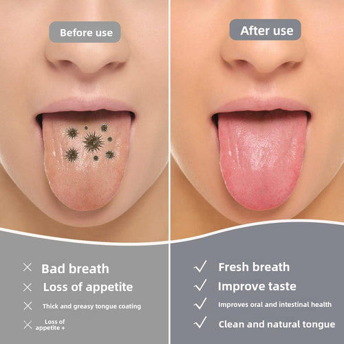 U-Shaped Tongue Scraper Oral Hygiene Tool