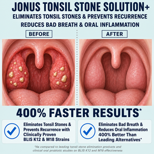 Oral Probiotic Tablets Fresh breath